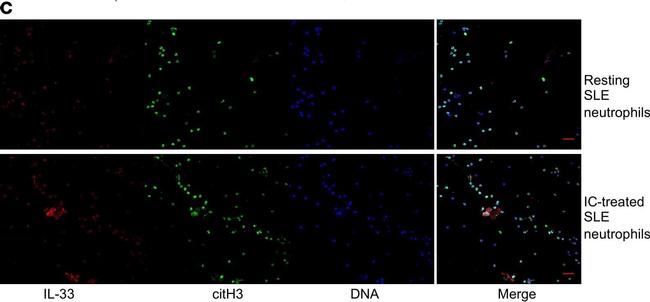 Rabbit IgG (H+L) Cross-Adsorbed Secondary Antibody in Immunocytochemistry (ICC/IF)