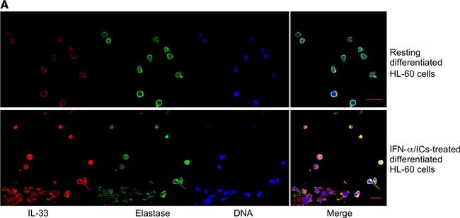 Rabbit IgG (H+L) Cross-Adsorbed Secondary Antibody in Immunocytochemistry (ICC/IF)