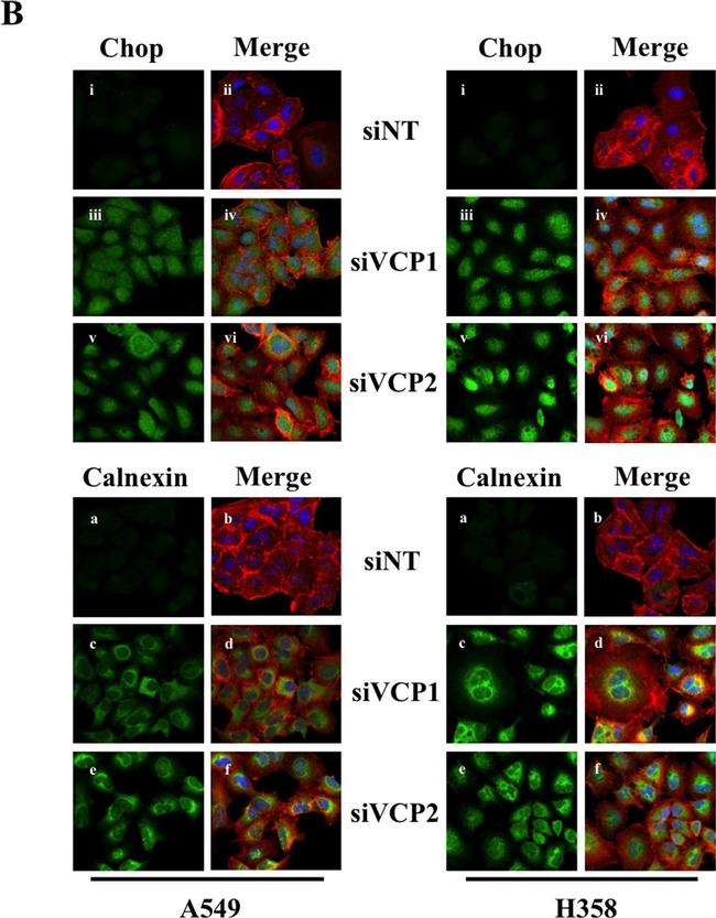 Mouse IgG (H+L) Cross-Adsorbed Secondary Antibody in Immunocytochemistry (ICC/IF)