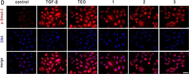 Rabbit IgG (H+L) Cross-Adsorbed Secondary Antibody in Immunocytochemistry (ICC/IF)