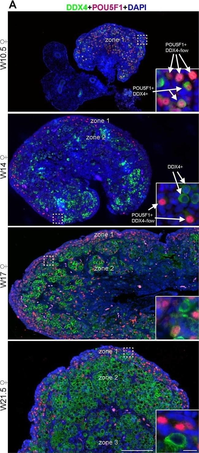 Goat IgG (H+L) Cross-Adsorbed Secondary Antibody in Immunohistochemistry (IHC)