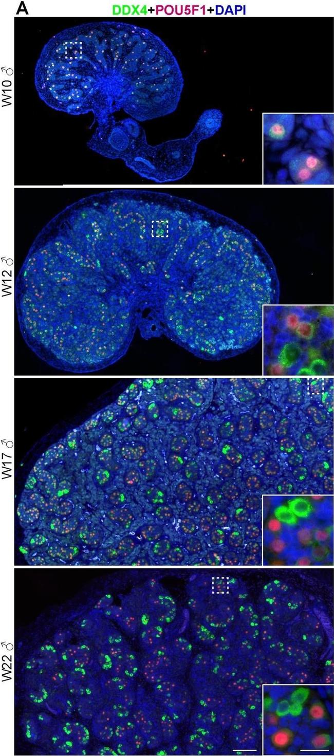 Goat IgG (H+L) Cross-Adsorbed Secondary Antibody in Immunohistochemistry (IHC)