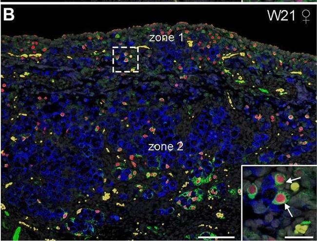 Goat IgG (H+L) Cross-Adsorbed Secondary Antibody in Immunohistochemistry (IHC)