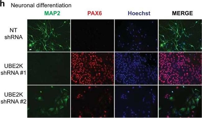 Mouse IgG (H+L) Highly Cross-Adsorbed Secondary Antibody in Immunocytochemistry (ICC/IF)