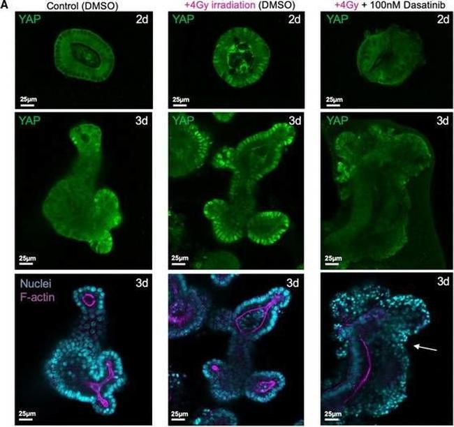 Mouse IgG (H+L) Highly Cross-Adsorbed Secondary Antibody in Immunohistochemistry (IHC)