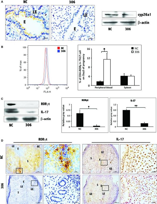 ROR gamma (t) Antibody in Western Blot, Immunohistochemistry, Flow Cytometry (WB, IHC, Flow)