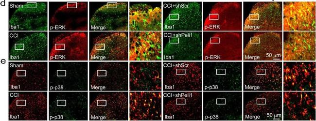 Rabbit IgG (H+L) Cross-Adsorbed Secondary Antibody in Immunohistochemistry (Frozen) (IHC (F))