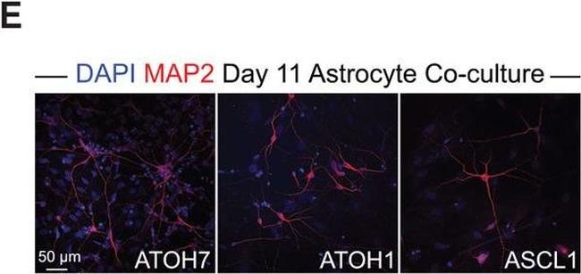 Rabbit IgG (H+L) Cross-Adsorbed Secondary Antibody in Immunocytochemistry (ICC/IF)