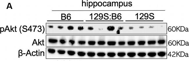 Rabbit IgG (H+L) Secondary Antibody in Western Blot (WB)