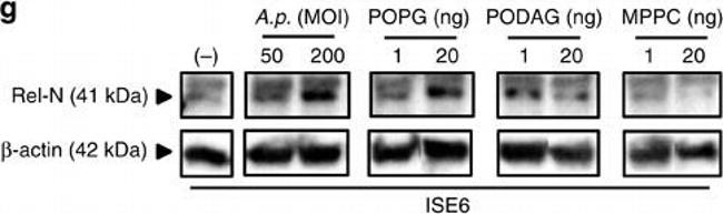 Rabbit IgG (H+L) Secondary Antibody in Western Blot (WB)