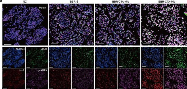 Mouse IgG (H+L) Highly Cross-Adsorbed Secondary Antibody in Immunocytochemistry (ICC/IF)