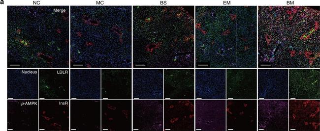 Mouse IgG (H+L) Highly Cross-Adsorbed Secondary Antibody in Immunohistochemistry (IHC)