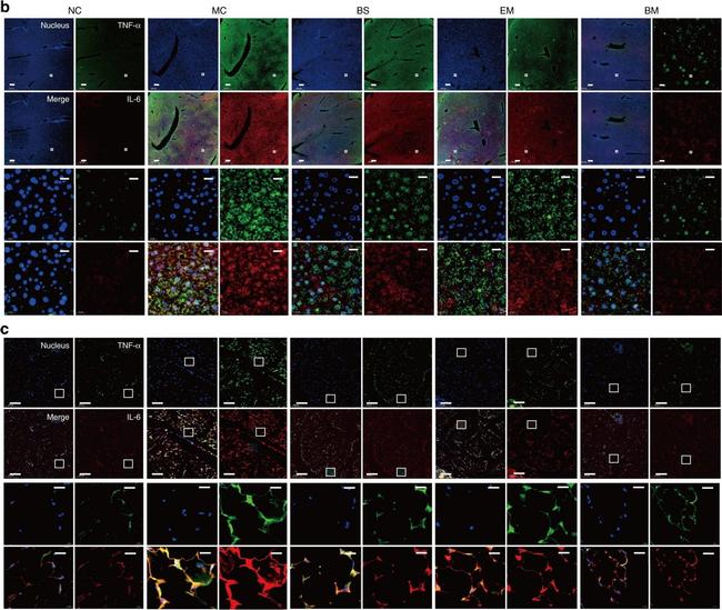 Mouse IgG (H+L) Highly Cross-Adsorbed Secondary Antibody in Immunohistochemistry (IHC)