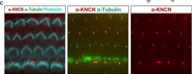 Mouse IgG (H+L) Highly Cross-Adsorbed Secondary Antibody in Immunohistochemistry (IHC)