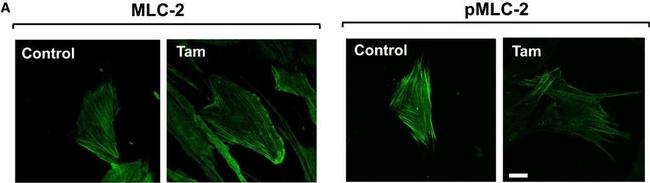 Mouse IgG (H+L) Highly Cross-Adsorbed Secondary Antibody in Immunocytochemistry (ICC/IF)