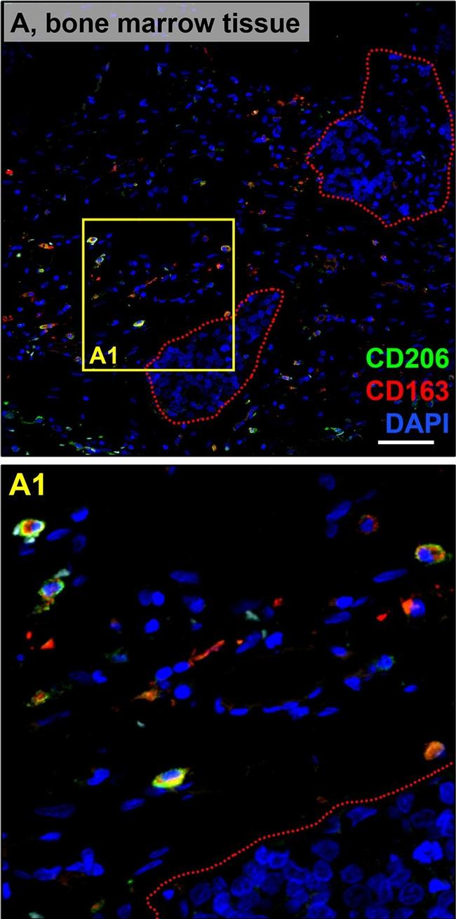 Mouse IgG (H+L) Highly Cross-Adsorbed Secondary Antibody in Immunohistochemistry (Paraffin) (IHC (P))