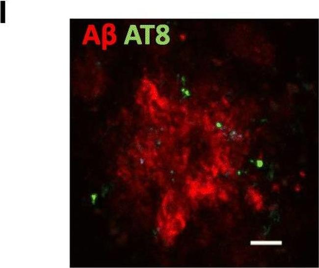 Mouse IgG (H+L) Highly Cross-Adsorbed Secondary Antibody in Immunohistochemistry (Frozen) (IHC (F))