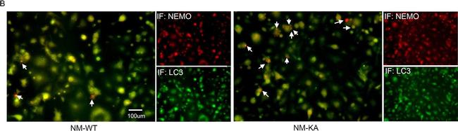 Rabbit IgG (H+L) Highly Cross-Adsorbed Secondary Antibody in Immunocytochemistry (ICC/IF)