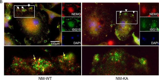 Mouse IgG (H+L) Highly Cross-Adsorbed Secondary Antibody in Immunocytochemistry (ICC/IF)