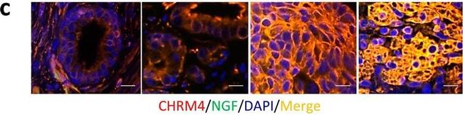 Rabbit IgG (Heavy chain) Secondary Antibody in Immunocytochemistry (ICC/IF)