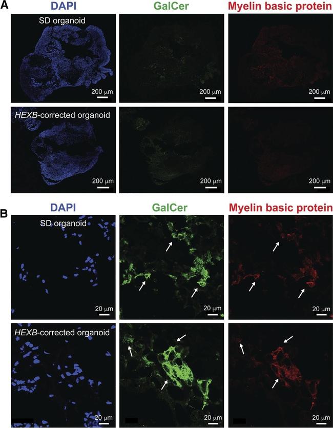 Mouse IgM (Heavy chain) Cross-Adsorbed Secondary Antibody in Immunohistochemistry (Frozen) (IHC (F))