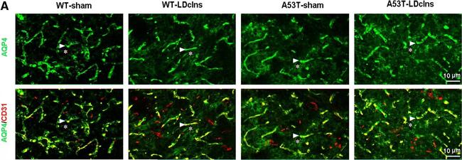 Mouse IgG (H+L) Highly Cross-Adsorbed Secondary Antibody in Immunohistochemistry (IHC)