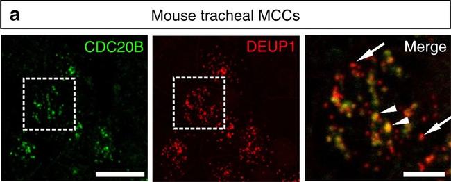 Rabbit IgG (H+L) Cross-Adsorbed Secondary Antibody in Immunocytochemistry (ICC/IF)