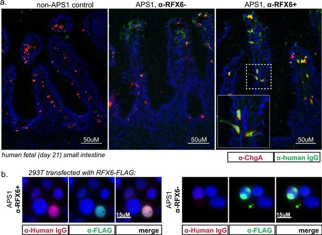 Rabbit IgG (H+L) Highly Cross-Adsorbed Secondary Antibody in Immunocytochemistry (ICC/IF)