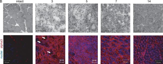 Rabbit IgG (H+L) Highly Cross-Adsorbed Secondary Antibody in Immunohistochemistry (PFA fixed) (IHC (PFA))