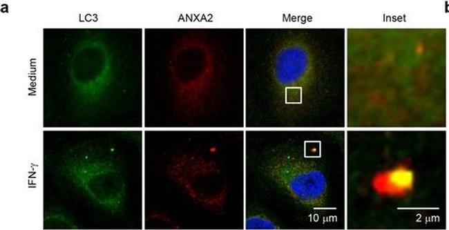 Mouse IgG (H+L) Highly Cross-Adsorbed Secondary Antibody in Immunocytochemistry (ICC/IF)