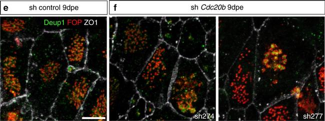 Mouse IgG2b Cross-Adsorbed Secondary Antibody in Immunocytochemistry (ICC/IF)