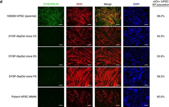 Rabbit IgG (H+L) Highly Cross-Adsorbed Secondary Antibody in Immunocytochemistry (ICC/IF)