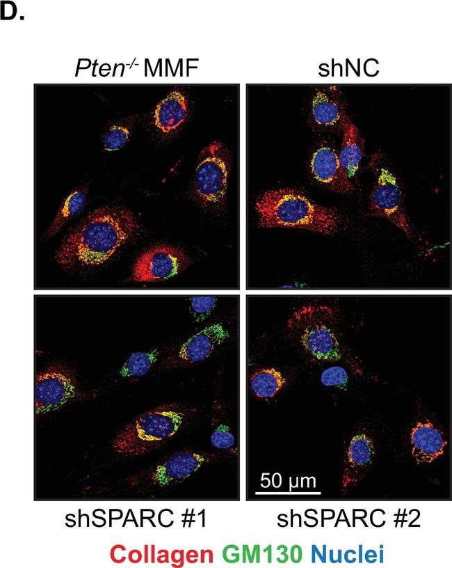 Rabbit IgG (H+L) Cross-Adsorbed Secondary Antibody in Immunocytochemistry (ICC/IF)