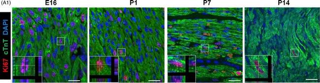 Mouse IgG (H+L) Highly Cross-Adsorbed Secondary Antibody in Immunohistochemistry (Paraffin) (IHC (P))