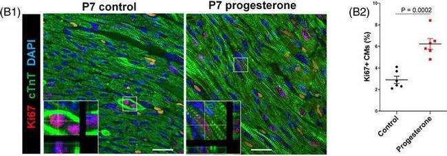 Mouse IgG (H+L) Highly Cross-Adsorbed Secondary Antibody in Immunohistochemistry (Paraffin) (IHC (P))