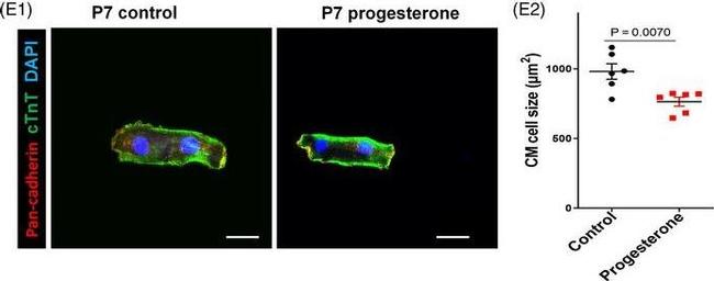 Mouse IgG (H+L) Highly Cross-Adsorbed Secondary Antibody in Immunocytochemistry (ICC/IF)