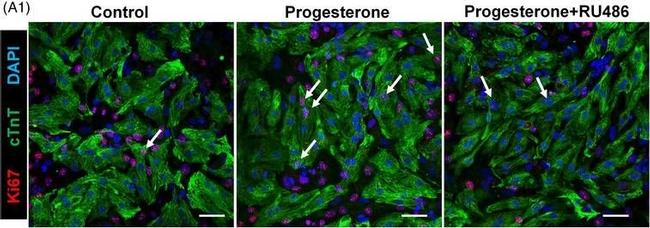 Mouse IgG (H+L) Highly Cross-Adsorbed Secondary Antibody in Immunocytochemistry (ICC/IF)