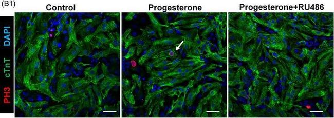 Mouse IgG (H+L) Highly Cross-Adsorbed Secondary Antibody in Immunocytochemistry (ICC/IF)