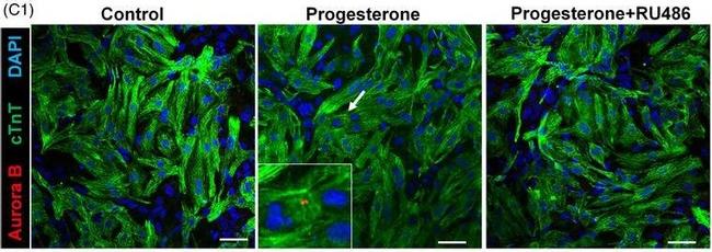 Mouse IgG (H+L) Highly Cross-Adsorbed Secondary Antibody in Immunocytochemistry (ICC/IF)