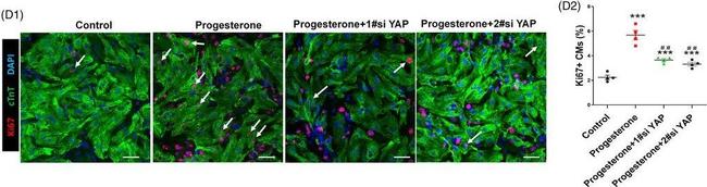 Mouse IgG (H+L) Highly Cross-Adsorbed Secondary Antibody in Immunocytochemistry (ICC/IF)