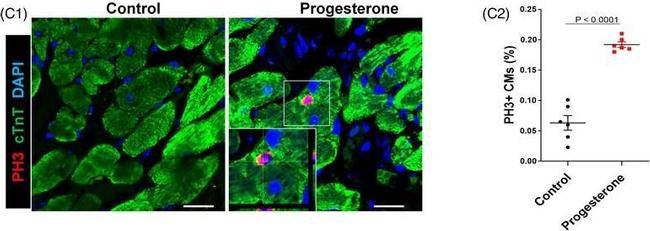 Mouse IgG (H+L) Highly Cross-Adsorbed Secondary Antibody in Immunohistochemistry (Paraffin) (IHC (P))