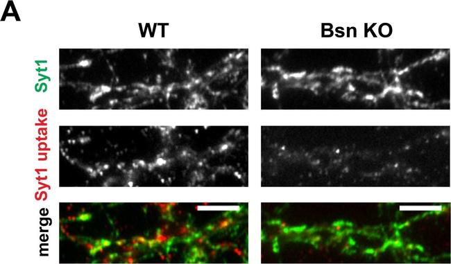 Mouse IgG (H+L) Highly Cross-Adsorbed Secondary Antibody in Immunocytochemistry (ICC/IF)