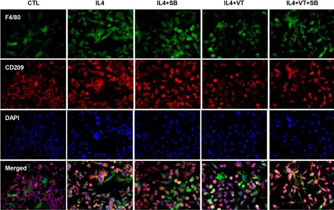 Mouse IgG1 Cross-Adsorbed Secondary Antibody in Immunocytochemistry (ICC/IF)