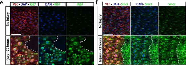 Goat IgG (H+L) Cross-Adsorbed Secondary Antibody in Immunocytochemistry (ICC/IF)