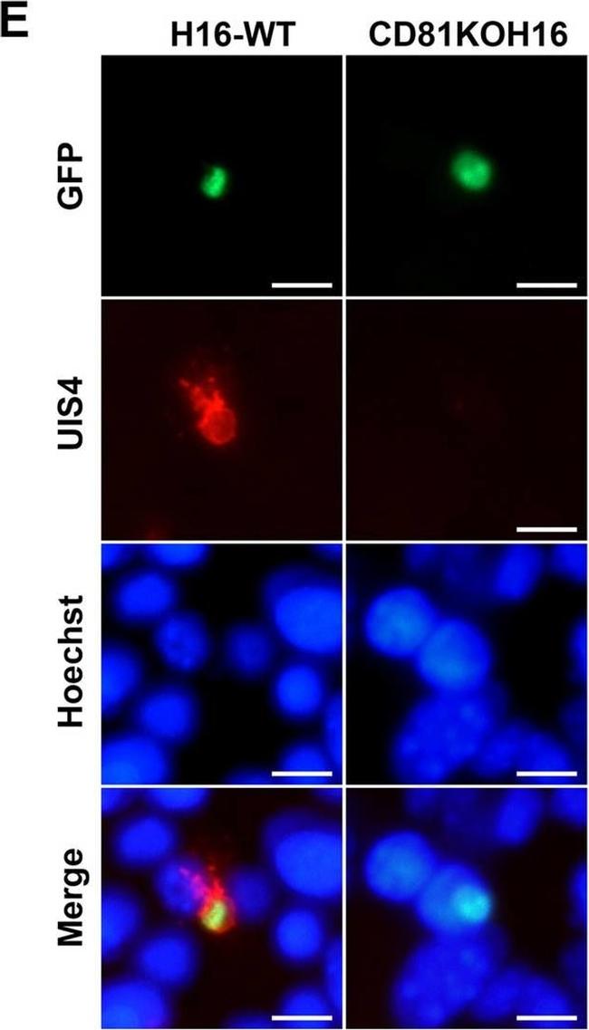 Goat IgG (H+L) Cross-Adsorbed Secondary Antibody in Immunocytochemistry (ICC/IF)