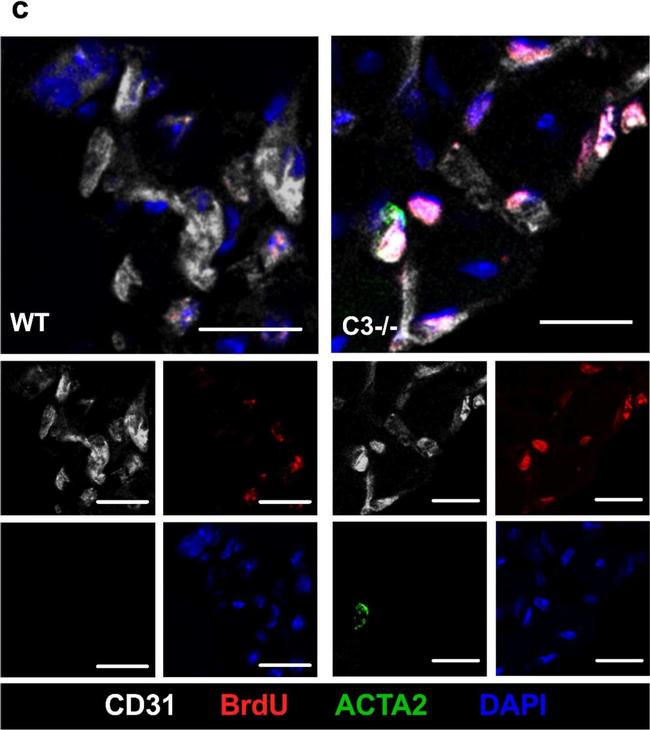 Rabbit IgG (H+L) Highly Cross-Adsorbed Secondary Antibody in Immunocytochemistry (ICC/IF)