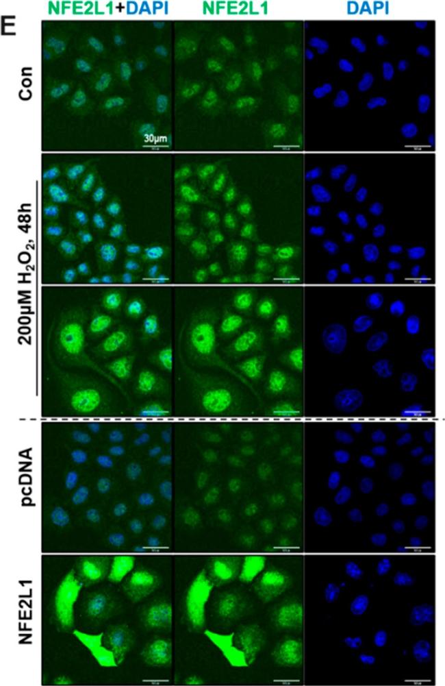 Mouse IgG (H+L) Cross-Adsorbed Secondary Antibody in Immunocytochemistry (ICC/IF)