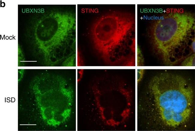 Rabbit IgG (H+L) Cross-Adsorbed Secondary Antibody in Immunocytochemistry (ICC/IF)