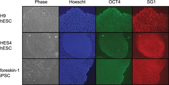 Rabbit IgG (H+L) Cross-Adsorbed Secondary Antibody in Immunocytochemistry (ICC/IF)