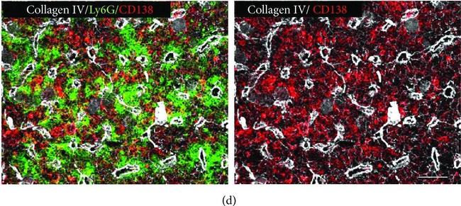 Rat IgG (H+L) Highly Cross-Adsorbed Secondary Antibody in Immunohistochemistry (Frozen) (IHC (F))